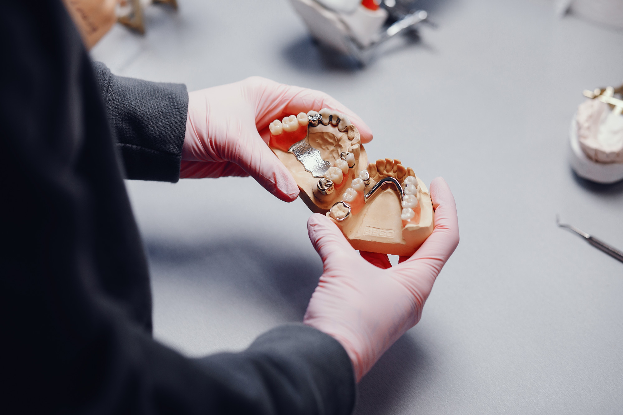 Mondzorgspecialist die afdruk met prothese vasthoudt